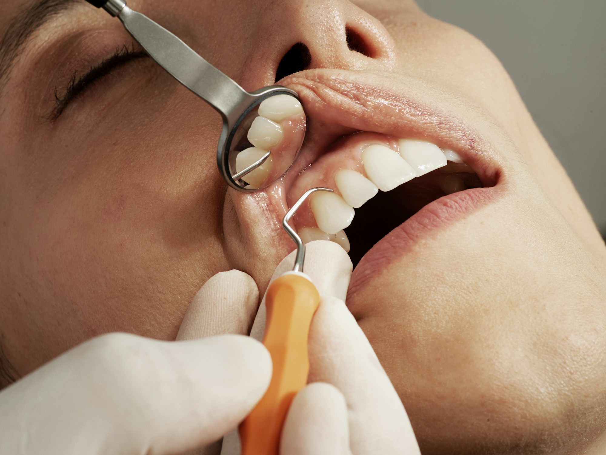 Bradford community dental team backs oral cancer campaignDentistry news | Dental News